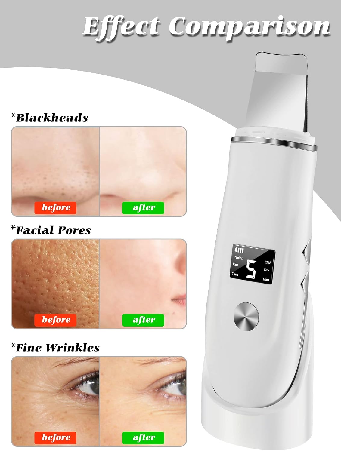 4 in 1 Ultrasonic Facial Skin Scrubber & Blackhead Remover Spatula - 12