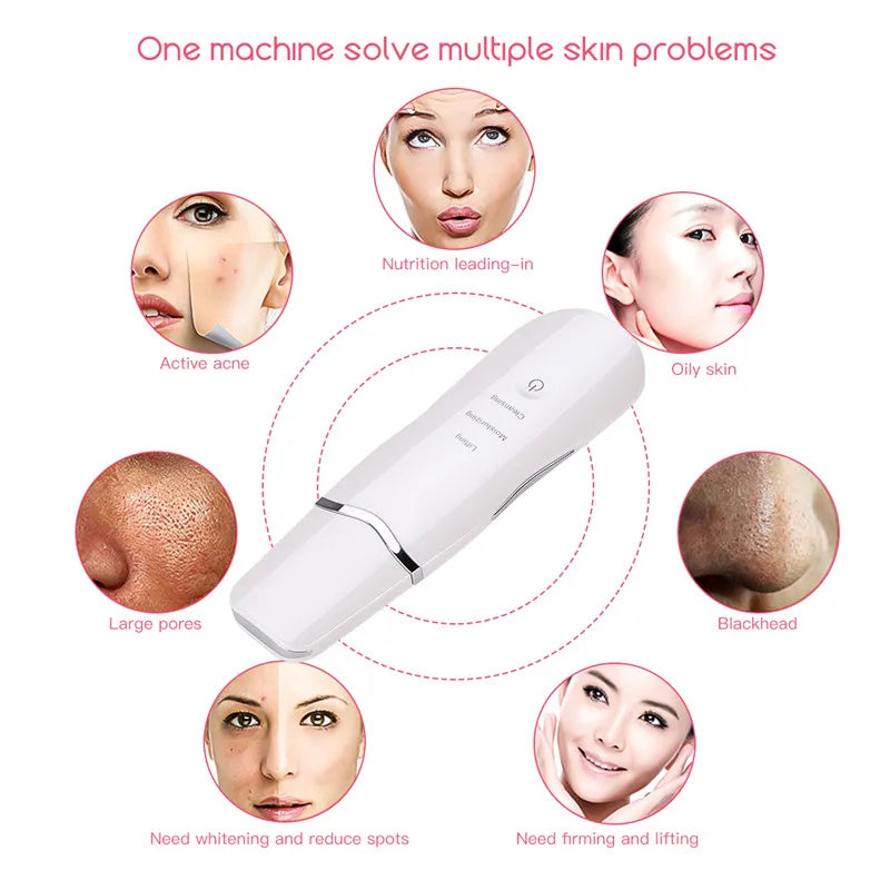 Ultrasonic Skin Scrubber Spatula Blackhead Remover - 10