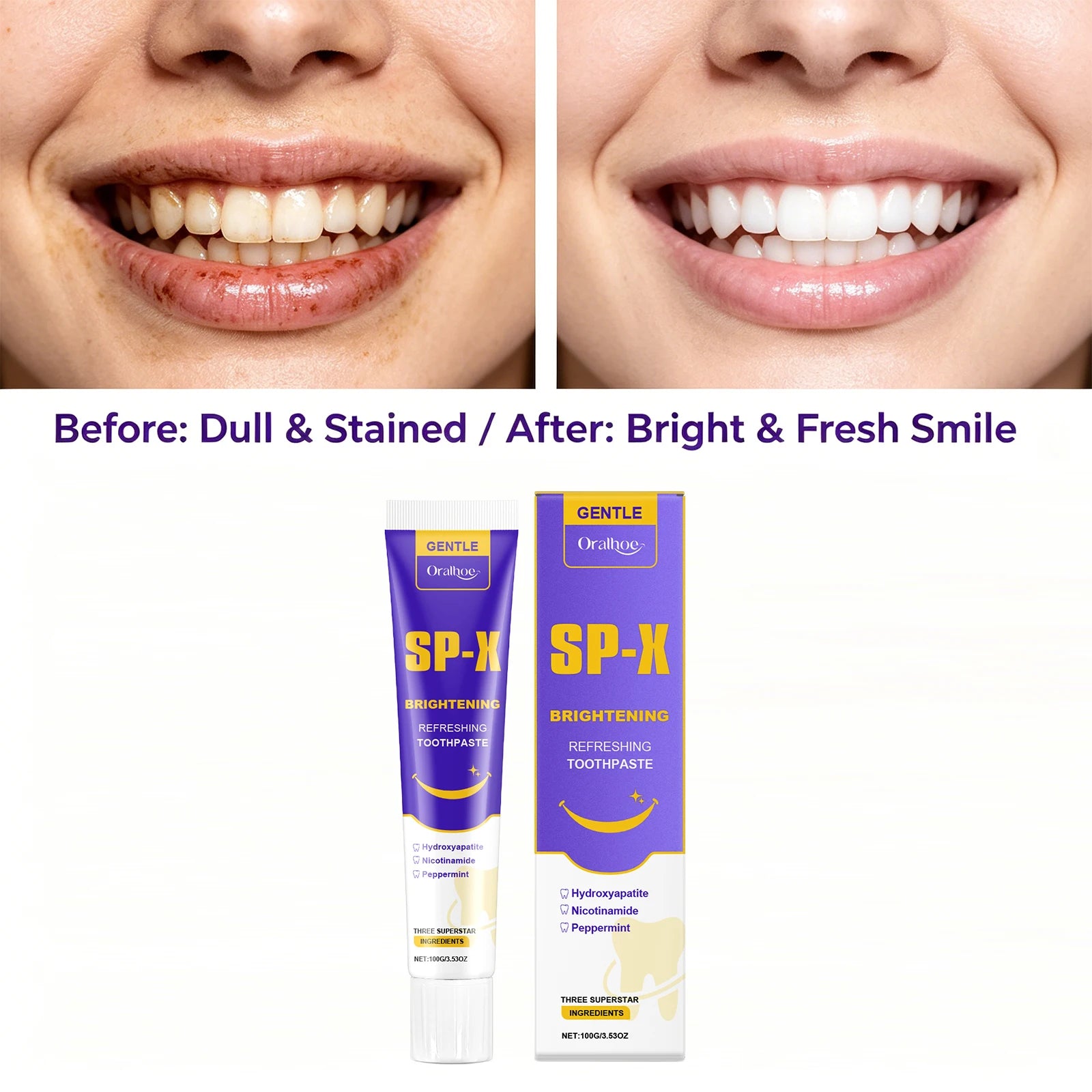 Sp X Brightening Toothpaste Teeth Whitening Stain Removal Enamel Care - 3