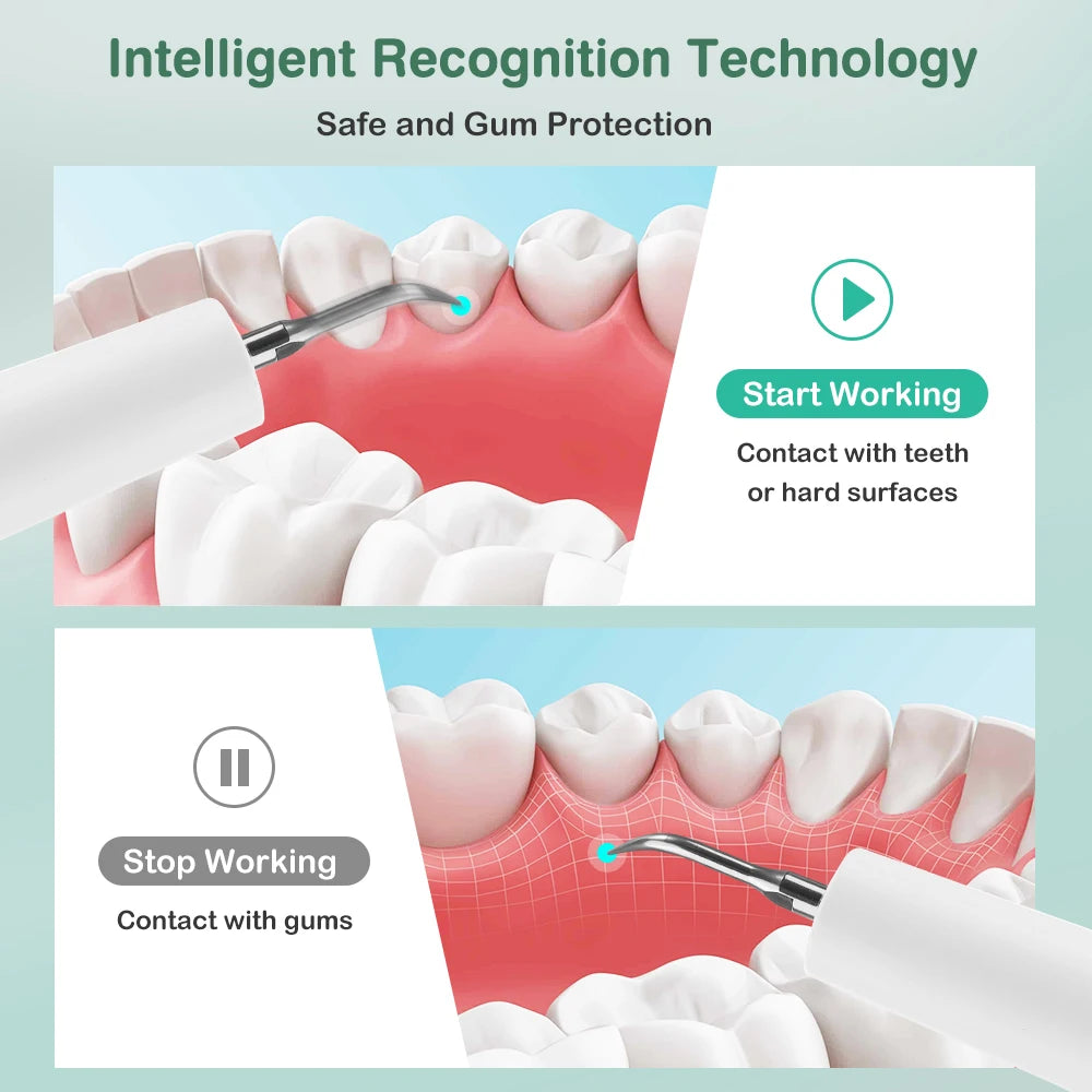 Ultrasonic Dental Scaler Teeth Tartar Remover Electric Cleaner