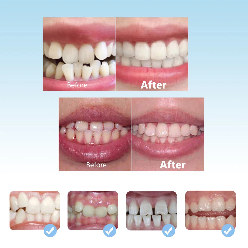 Kids Dental Orthodontic Braces 3 Stage Teeth Alignment Trainer - 7