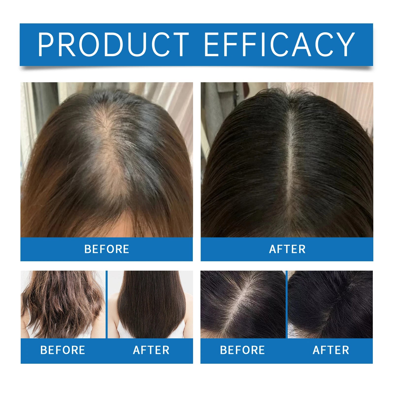 Rosemary Hair Growth Serum Roller Split Ends Repair Oil - 4