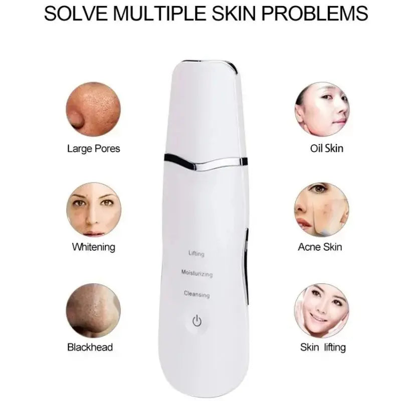 Ultrasonic Skin Scrubber Spatula Blackhead Remover - 4
