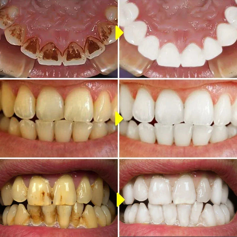 SP-6 Probiotic Whitening Toothpaste Stain Remover Teeth Whitener - 2
