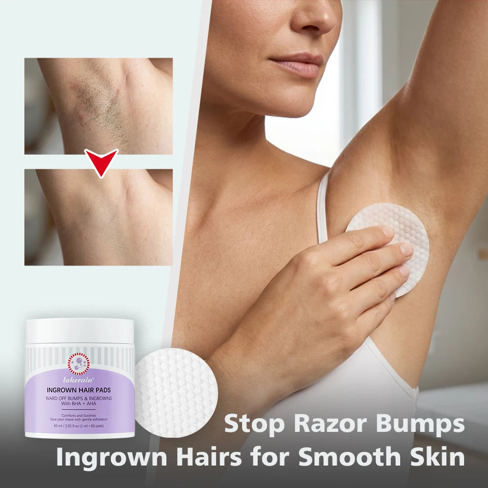 Ingrown Hair Treatment Pads Exfoliating Razor Bumps Aftershave Care