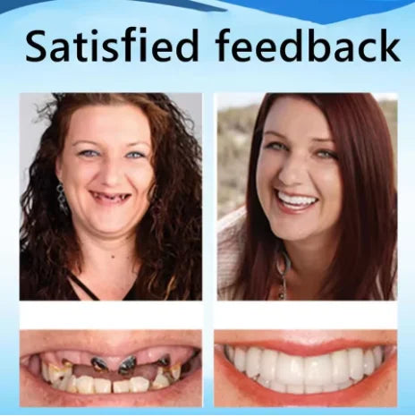 Slim Custom Fit Dentures Boil to Shape Comfort Denture - 5
