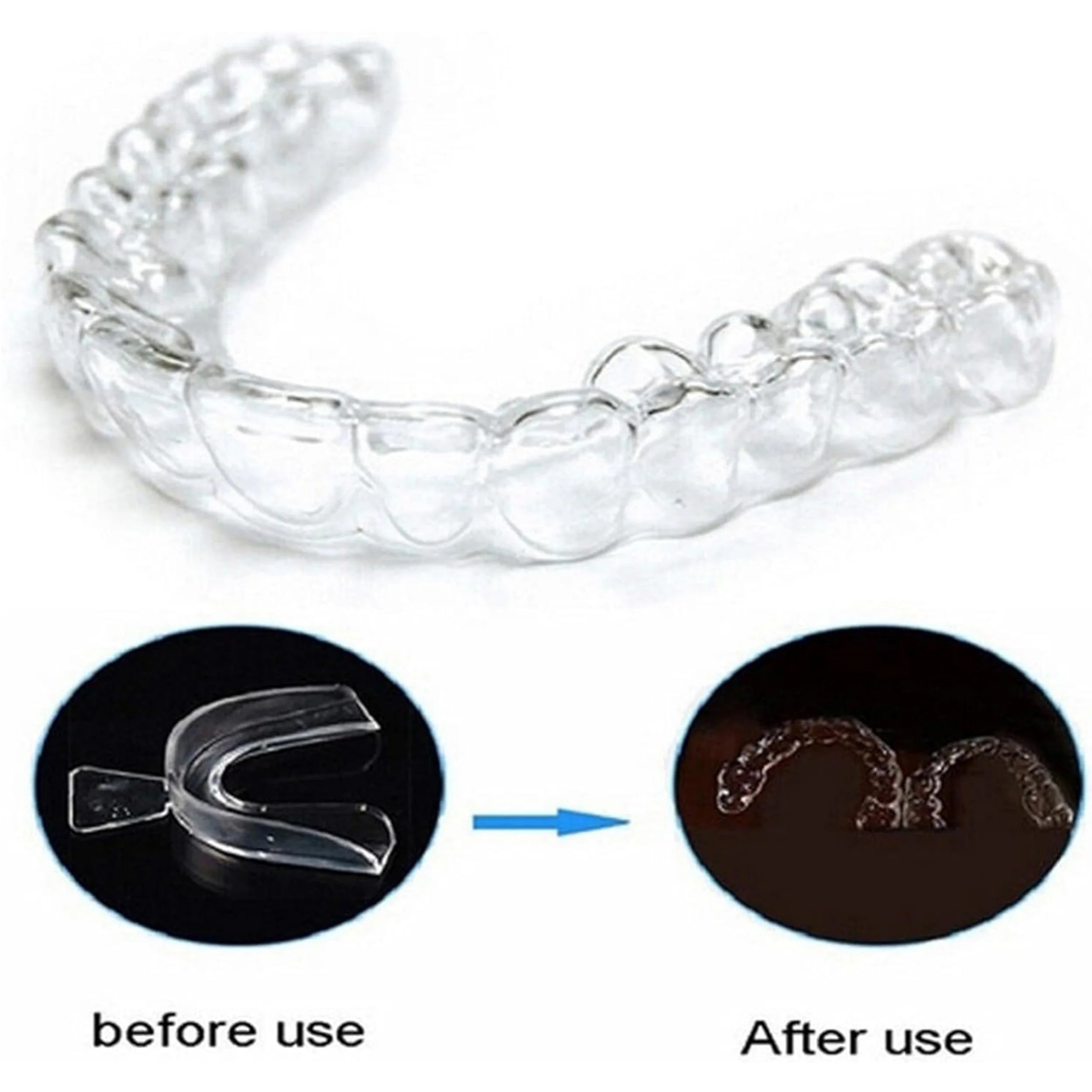 Silicone Mouth Guard Teeth Tray for Night Grinding and Teeth Whitening - 3