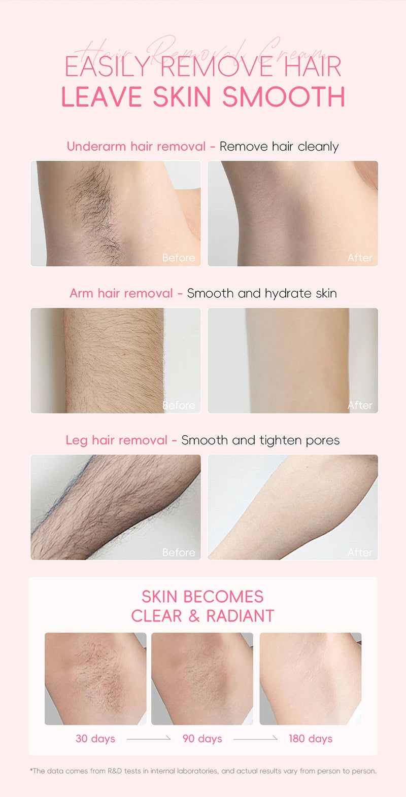 Eelhoe Hair Removal Cream Painless Body Epilator and Growth Inhibitor - 13