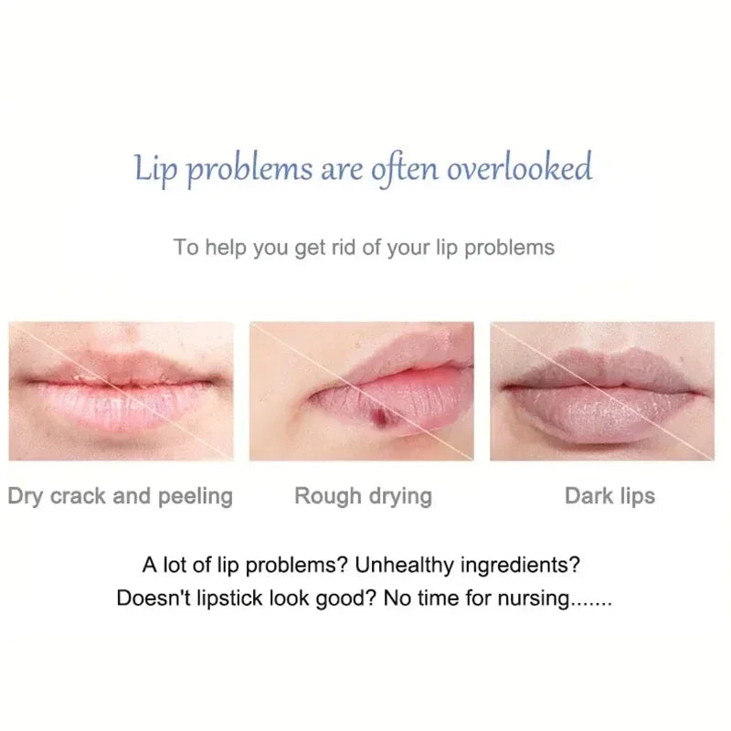 Dark Spot Lip Balm Lightening Mask and Exfoliating Lip Care Treatment