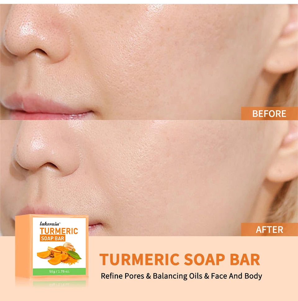 Turmeric Lemon Kojic Acid Soap Natural Skincare Bar - 9