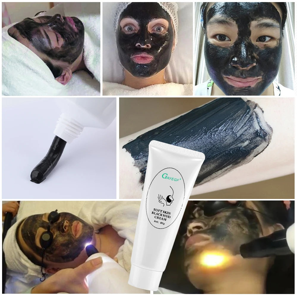 Carbon Gel Laser Toner Skin Rejuvenation Black Face Mask Cream - 8