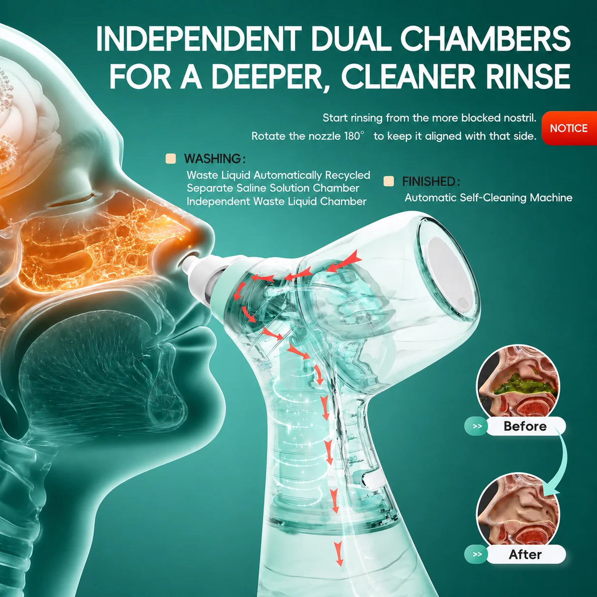 Mornwell Electric Nasal Irrigator Sinus Rinse Machine