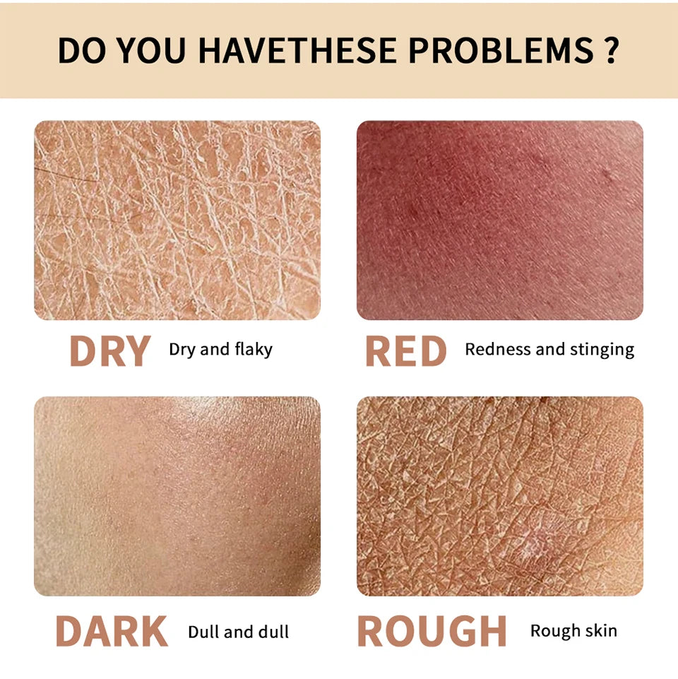 Lakerain Hydrogel Facial Cream Deep Hydrating Face Skin Care