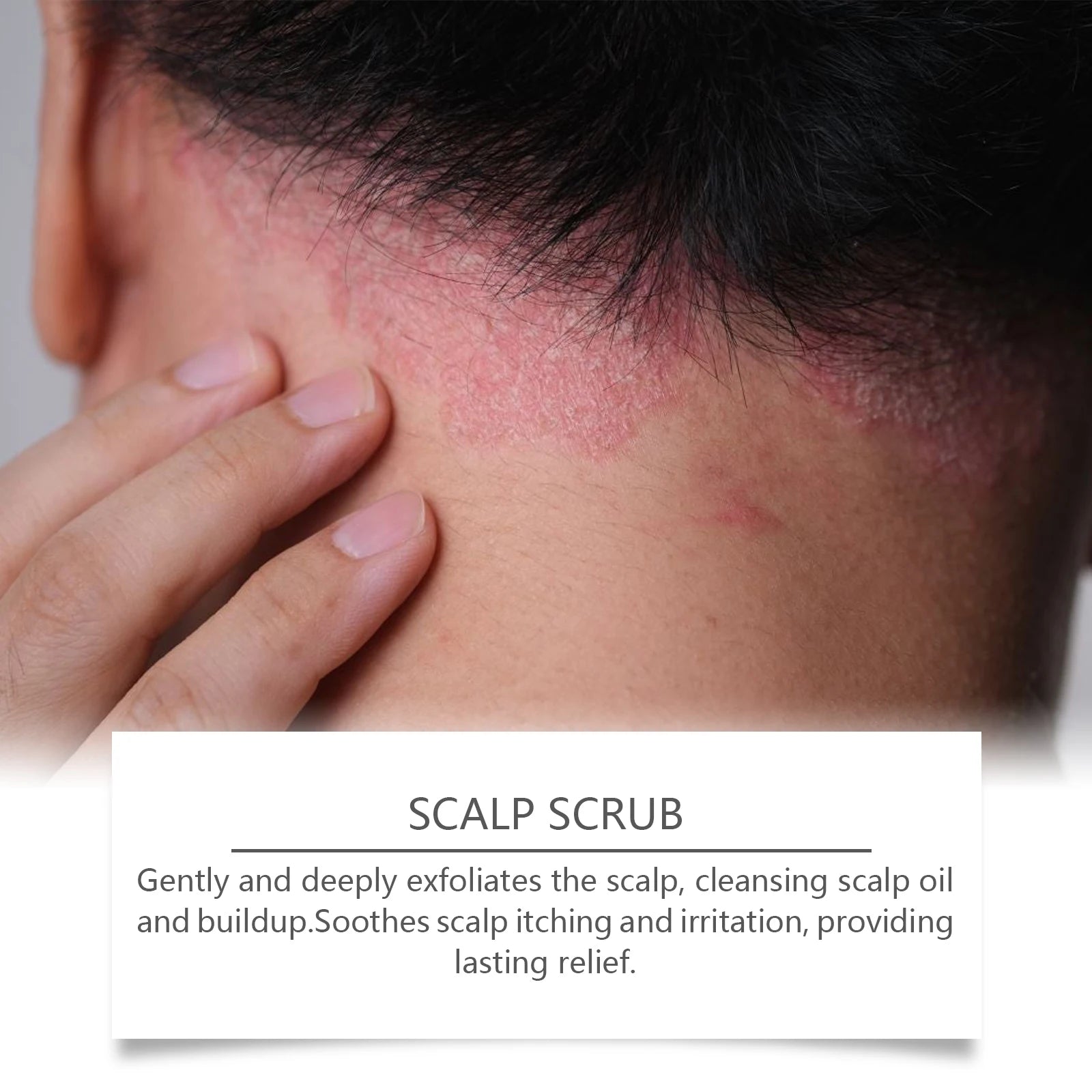 Scalp Scrub Deep Cleansing Exfoliator Dandruff Relief Hair Care - 9