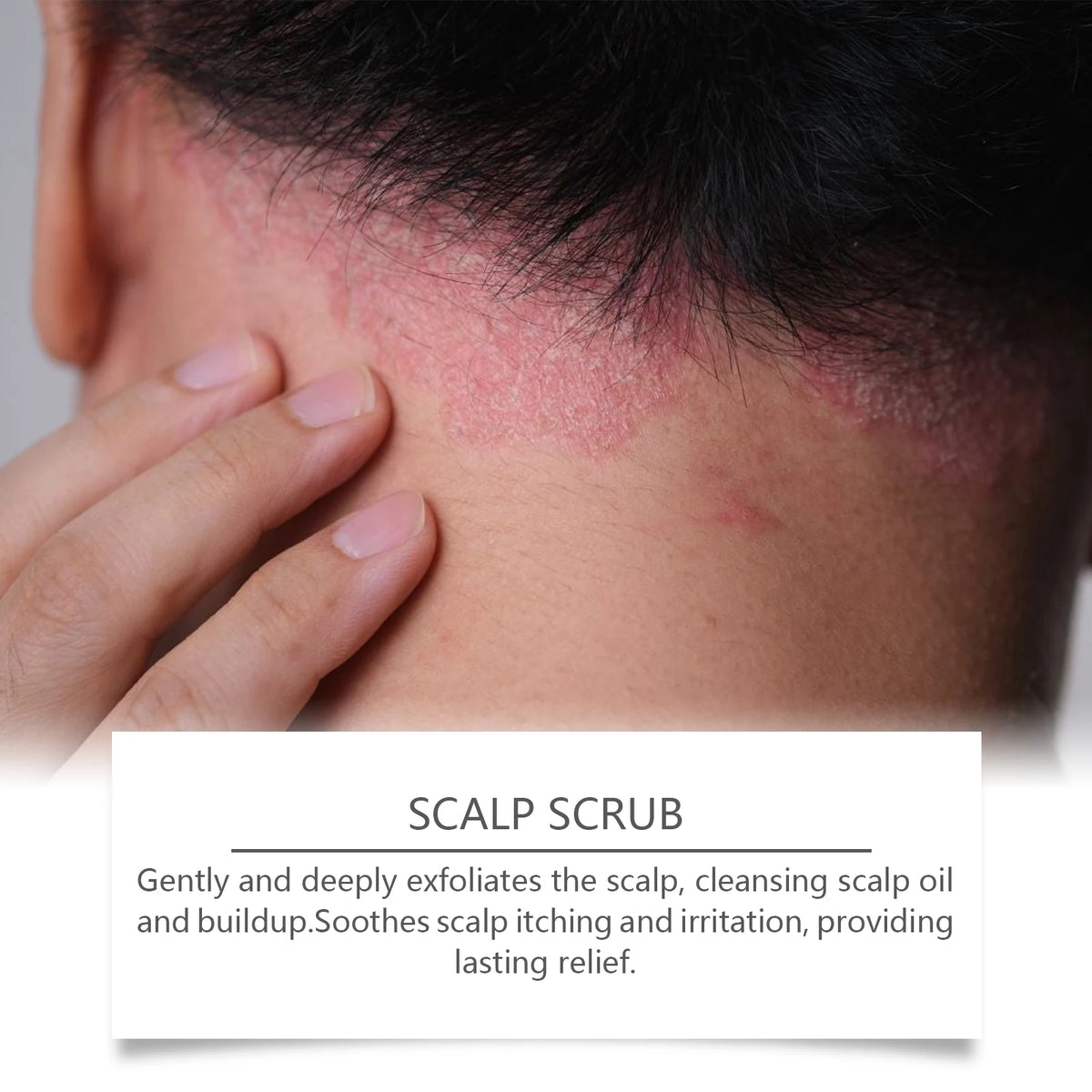 Scalp Scrub Deep Cleansing Exfoliator Dandruff Relief Hair Care