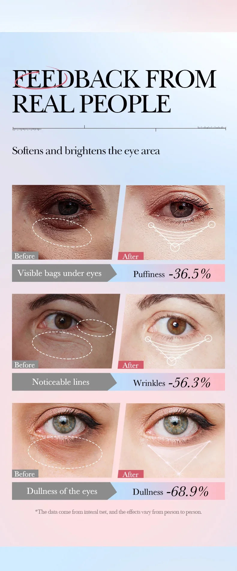 Anti Wrinkle Eye Cream Dark Circles and Fine Lines Remover