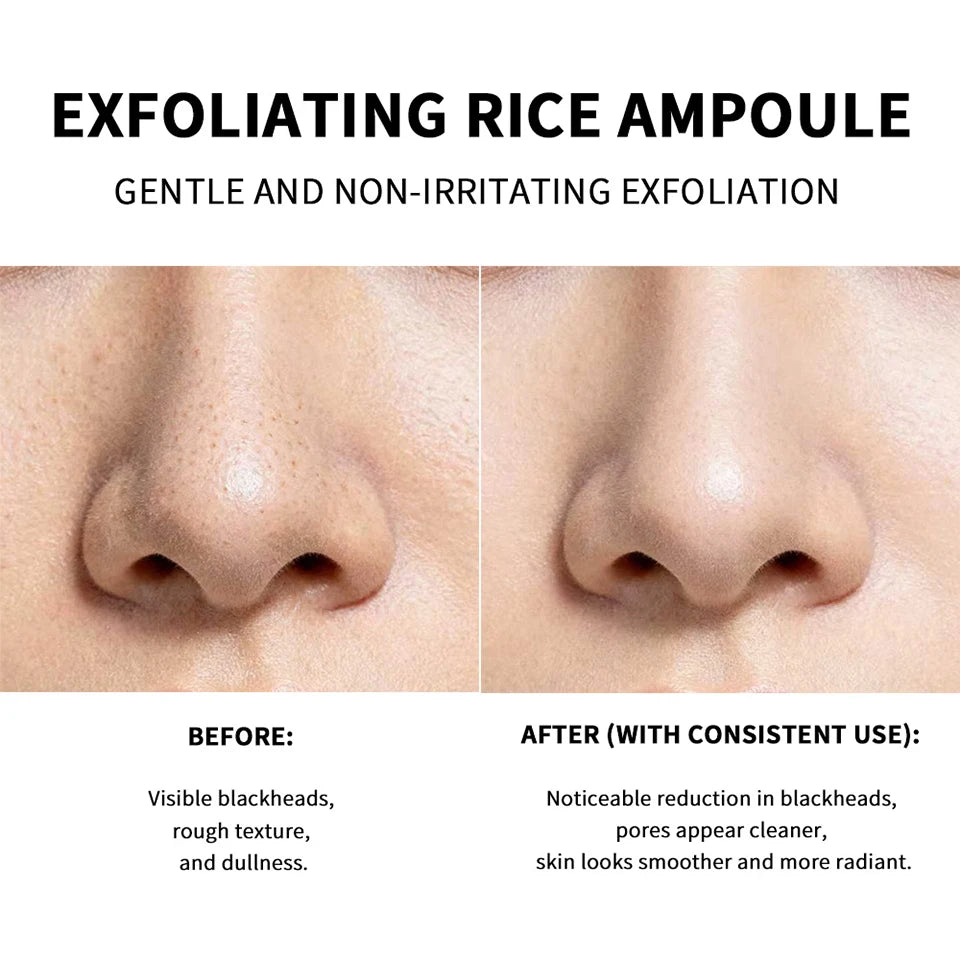 White Black Rice Exfoliating Serum Peeling Hydrating Toner