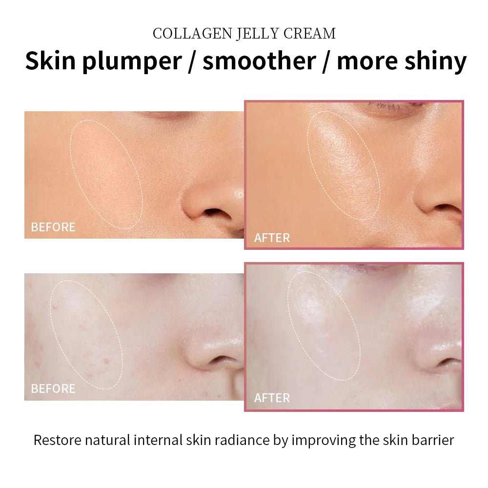 Collagen Jelly Cream Niacinamide Firming Moisturizer Skincare Gel - 4