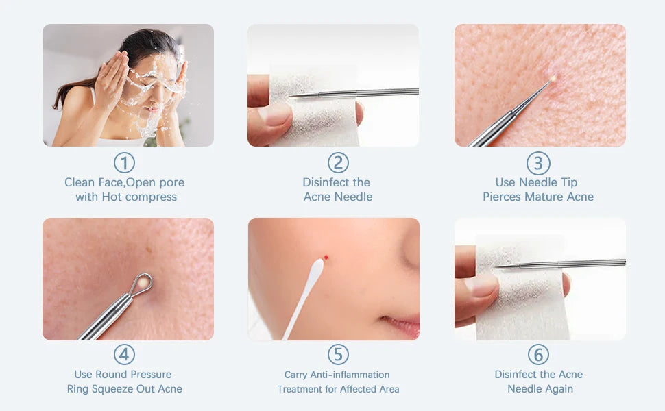 Stainless Steel Blackhead Remover Tool Kit Pimple Extractor