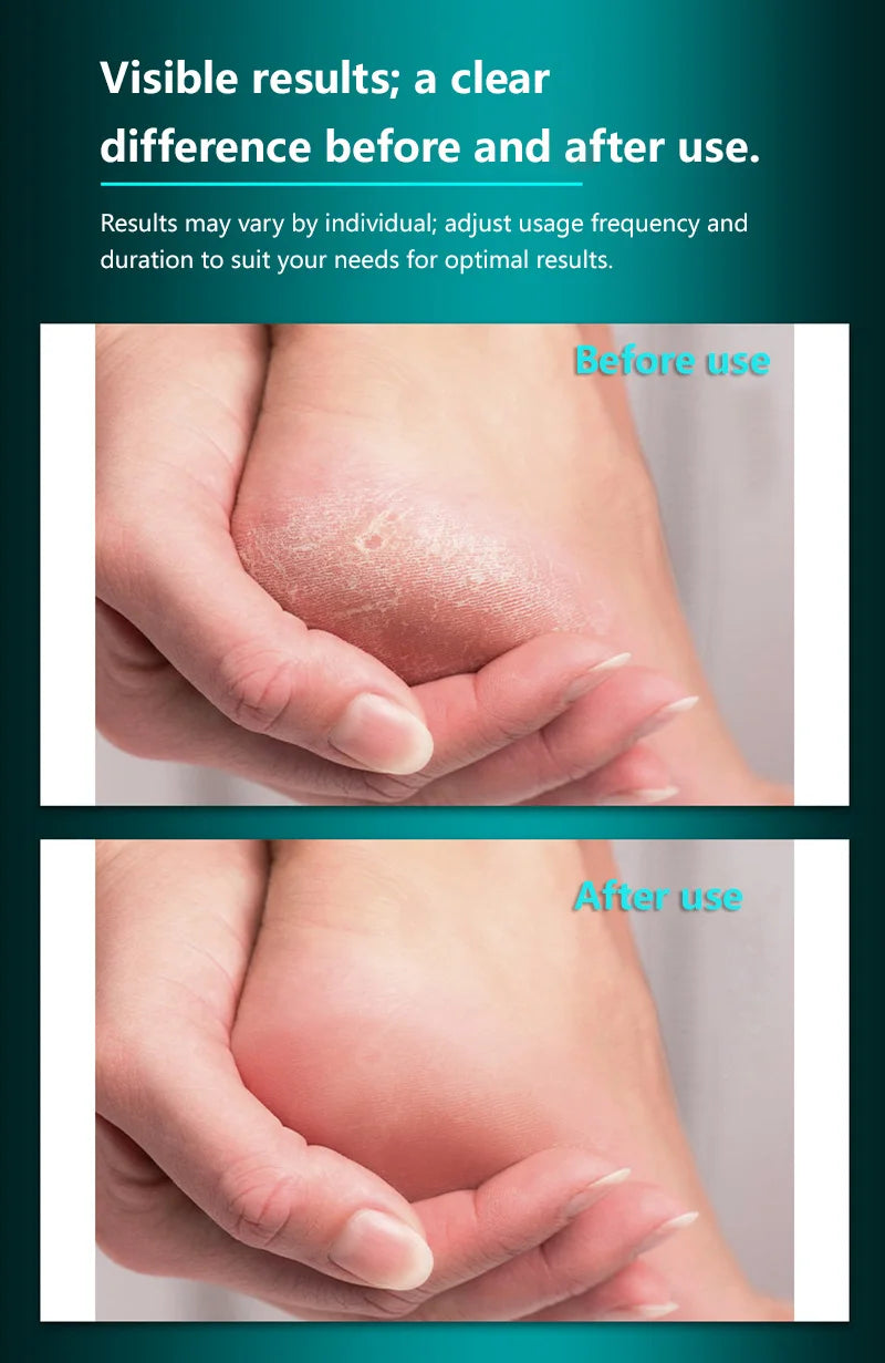 Professional Stainless Steel Foot File Cracked Heel Remover Pedicure Care