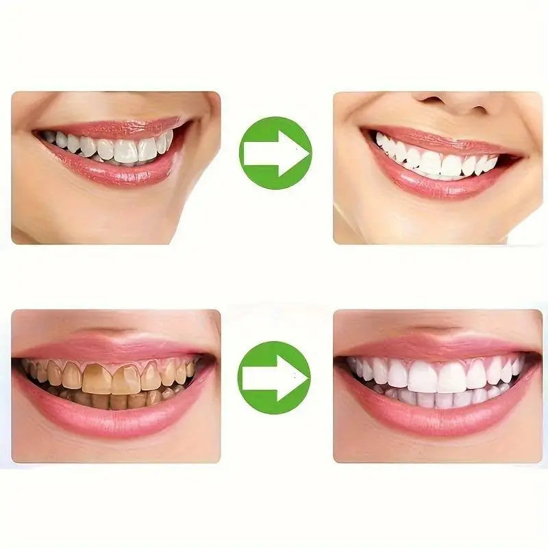 Silicone Mouth Guard Teeth Tray for Night Grinding and Teeth Whitening