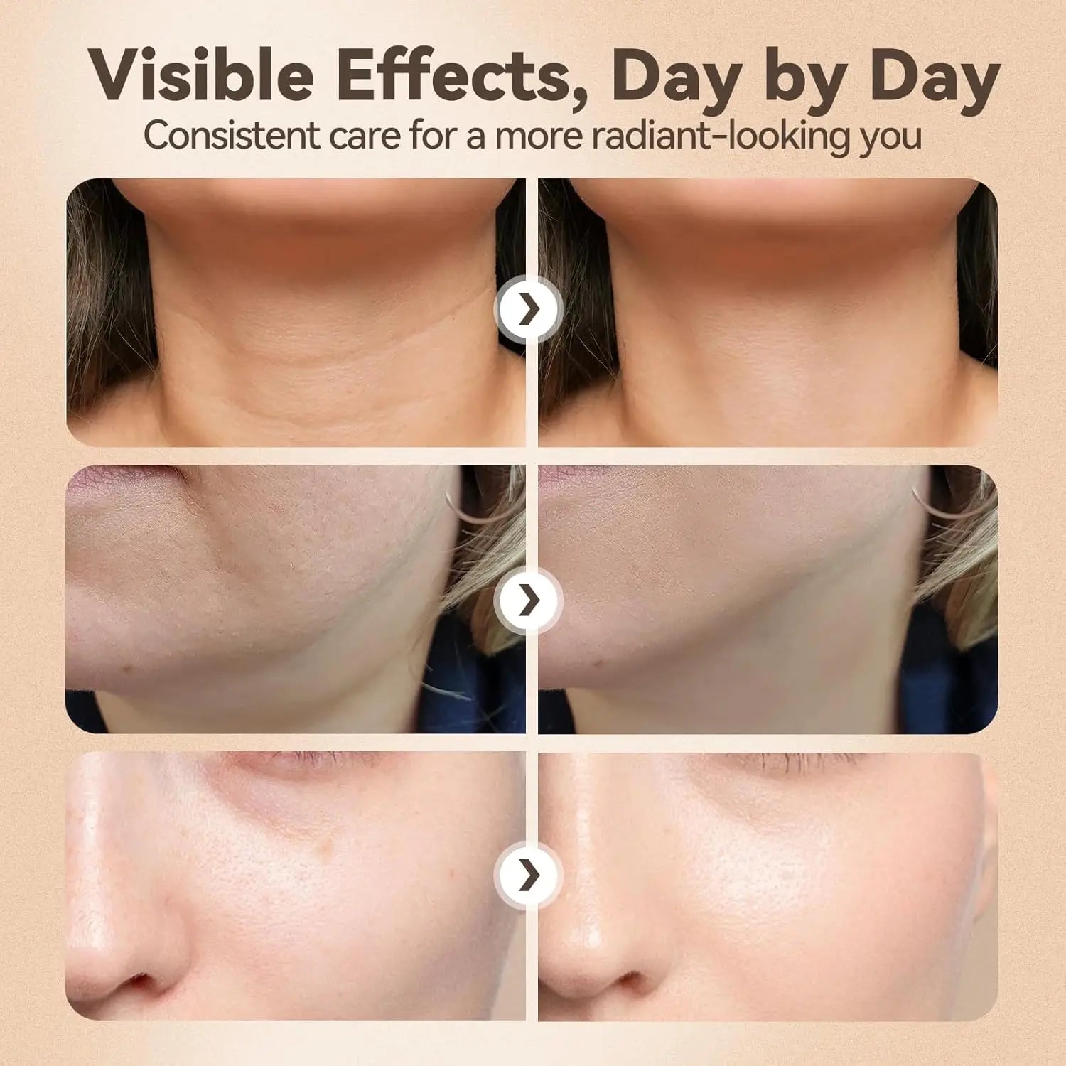 3 in 1 Facial Massager & Skin Tightening Sculpting Device - 4