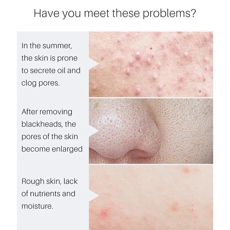 Pore Minimizing Serum Face Tightening Skin Repair Treatment