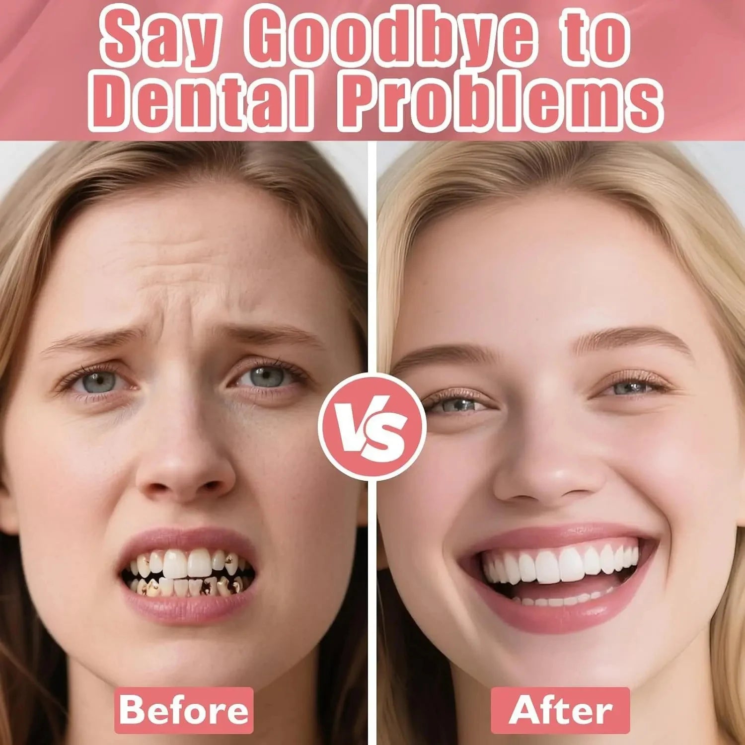 Realistic Full Denture Set Temporary False Teeth Veneers - 10