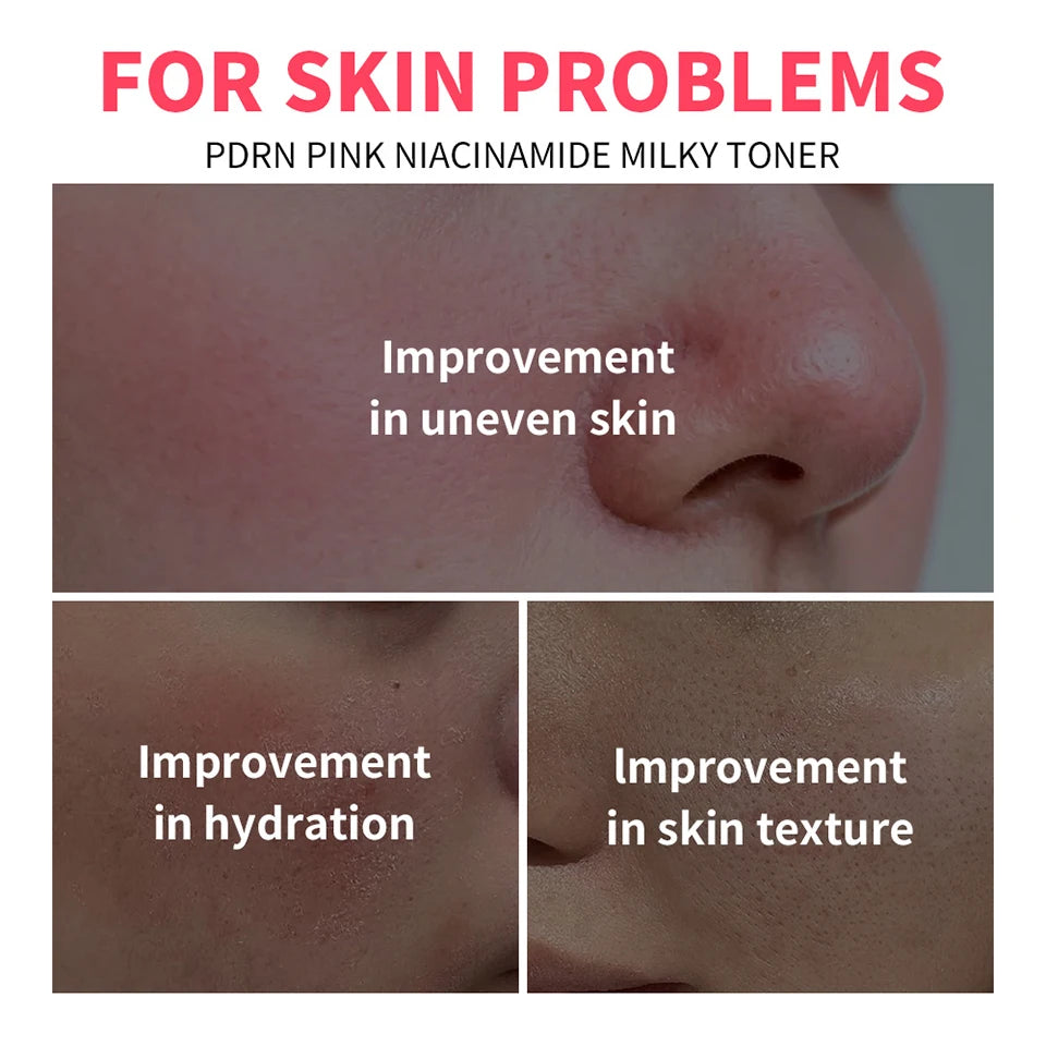 PDRN Pink Niacinamide Milky Toner Hydrating Facial Lotion - 8