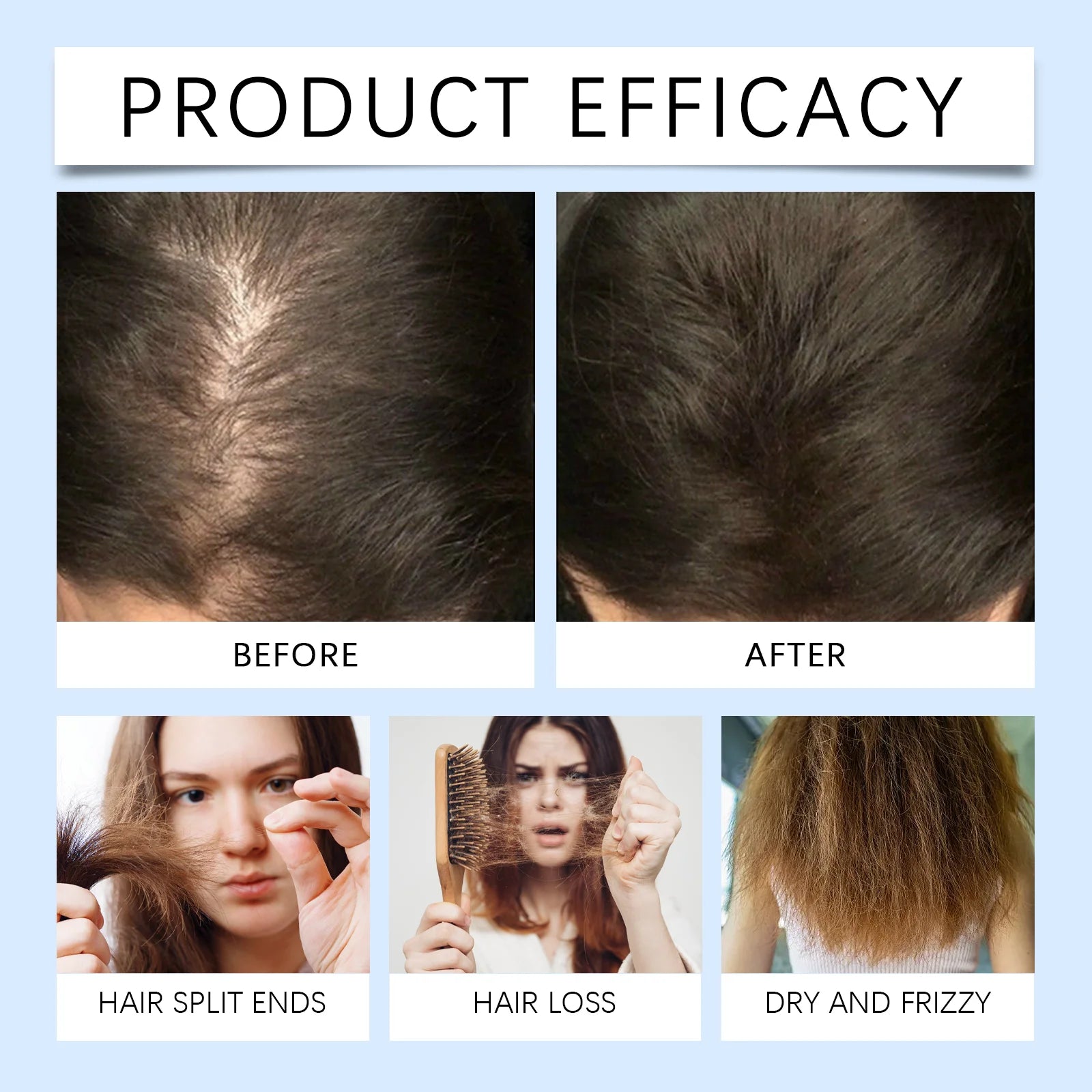 Rosemary Hair Growth Serum Roll-on Scalp Nourishing Hair Roller - 10