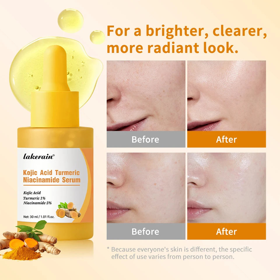 Lakerain Kojic Acid Turmeric Niacinamide Face Serum Brightening Oil - 11