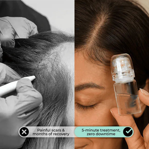 Microneedle Hair Regrowth Care Kit Scalp Serum Treatment - 3