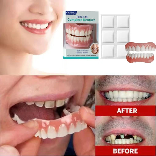 Silicone Dentures Full Mouth Fake Teeth Veneers