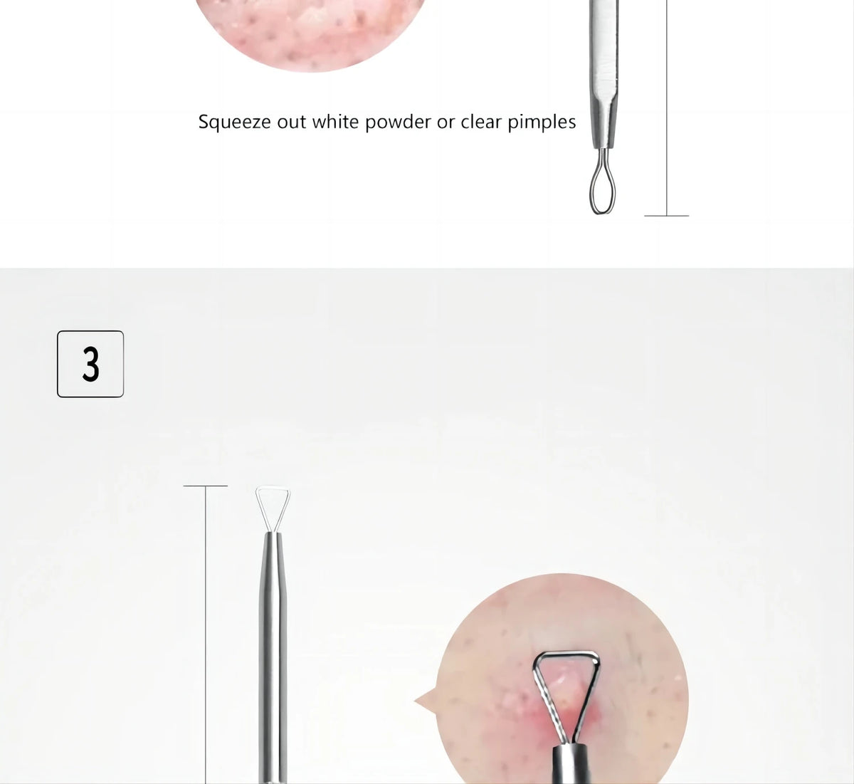 Stainless Steel Blackhead Remover Tool Kit Pimple Extractor