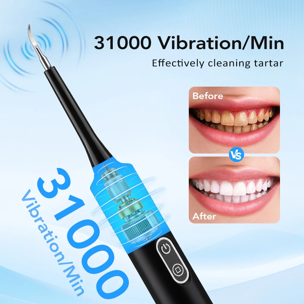 Electric Sonic Dental Scaler and Teeth Whitening Plaque Remover - 9