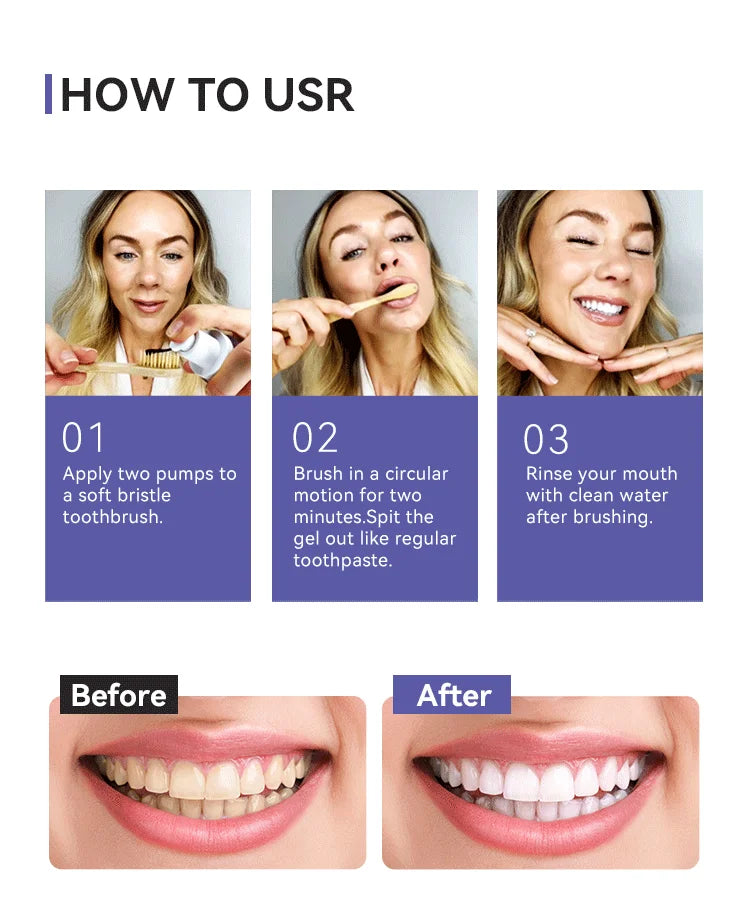 Portable Water Flosser and Teeth Whitening Kit Oral Care - 17