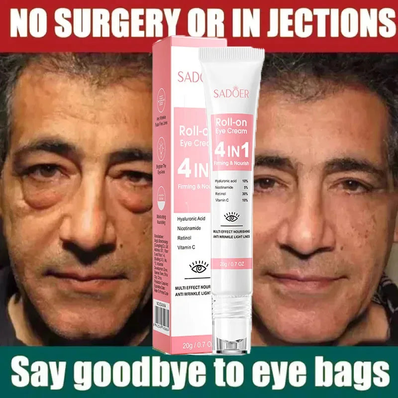 Anti Wrinkle Eye Cream Dark Circles and Fine Lines Remover - 8