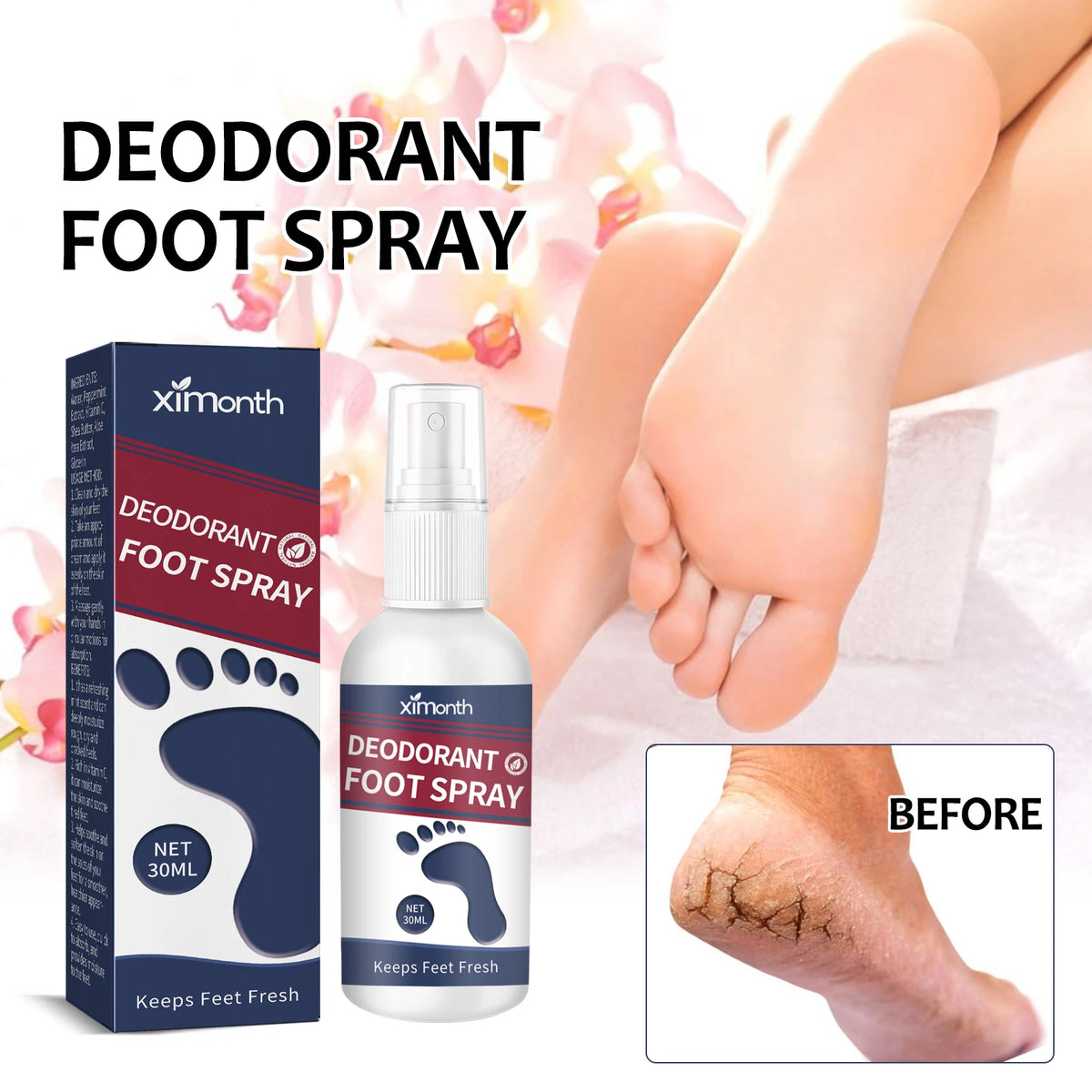 Ximonth Foot Deodorant Spray Odor Removal & Care