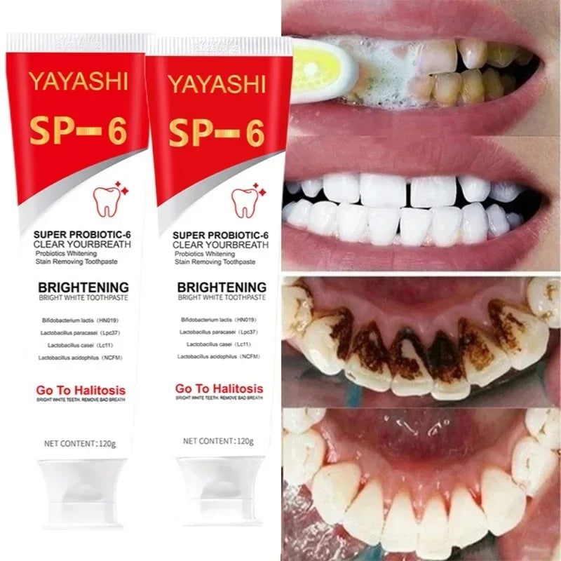 SP-6 Probiotic Whitening Toothpaste Stain Remover Teeth Whitener - 1