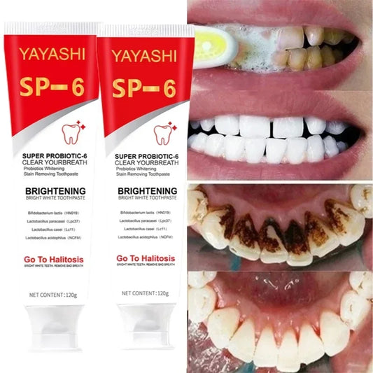 SP-6 Probiotic Whitening Toothpaste Stain Remover Teeth Whitener