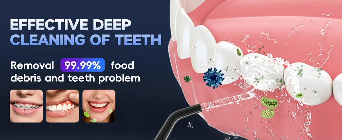 Cordless Water Flosser Dental Oral Irrigator Teeth Cleaner F18