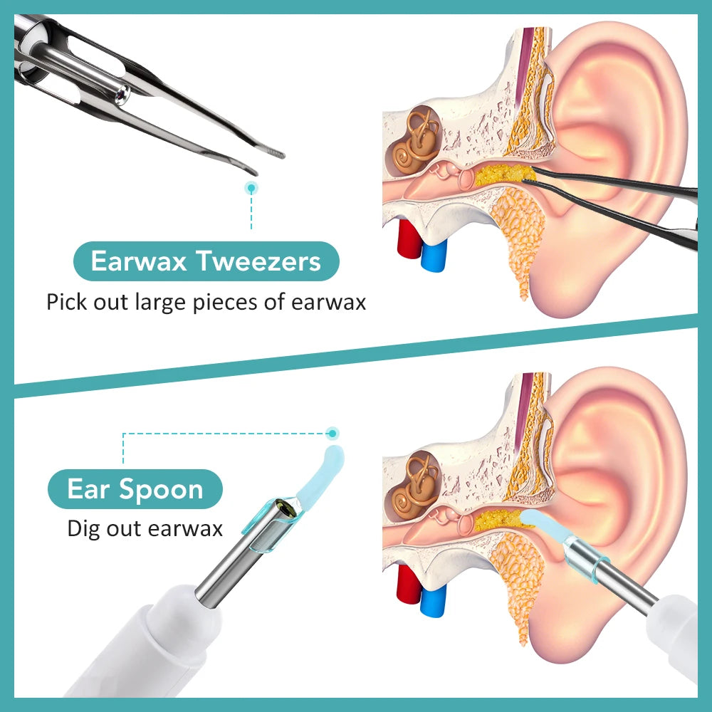 Smart Visual Ear Wax Cleaner HD Camera Earpick - 9