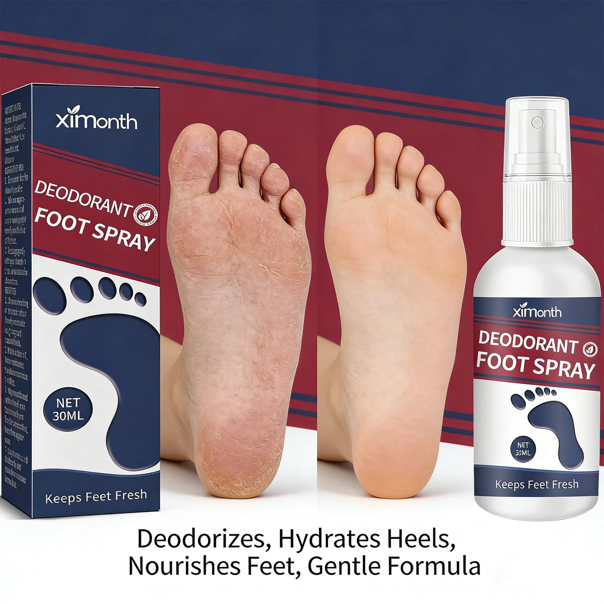 Ximonth Foot Deodorant Spray Odor Removal & Care