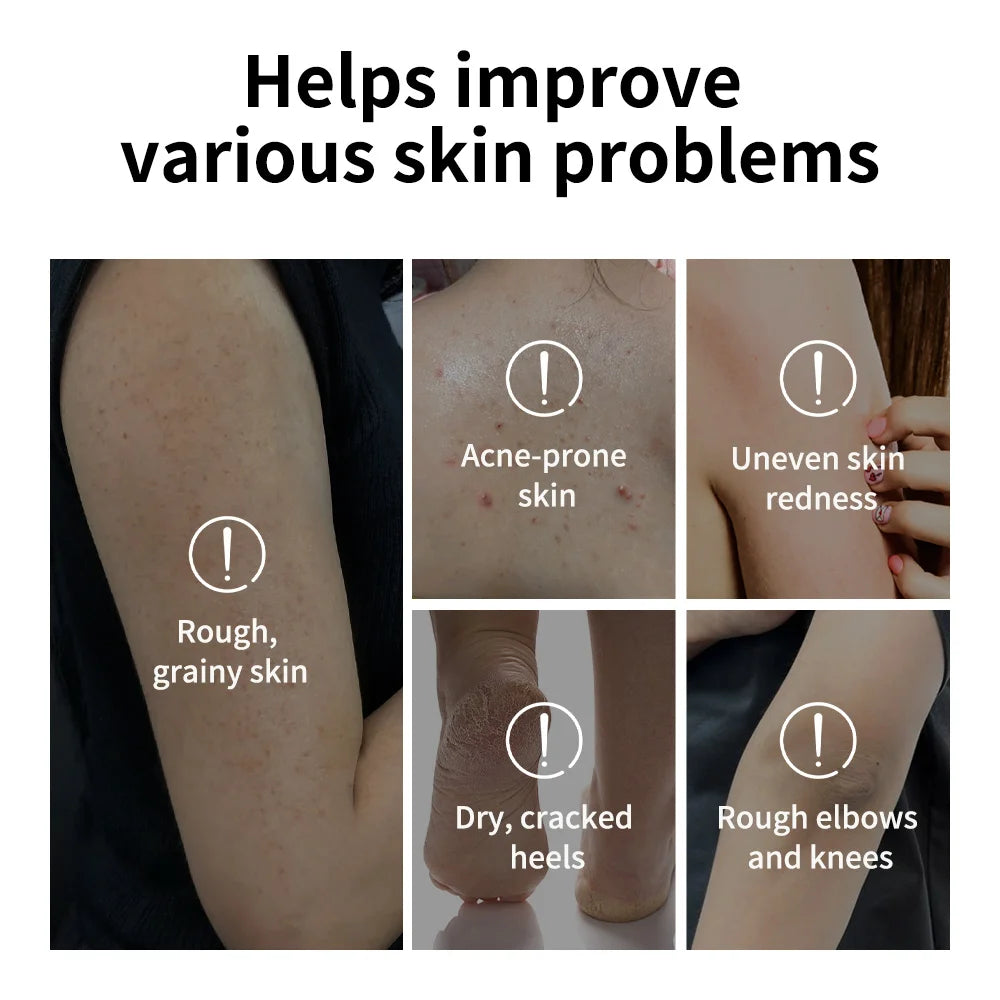 Lakerain Glycolic Acid Exfoliating Body Stick Skincare Scrub - 5