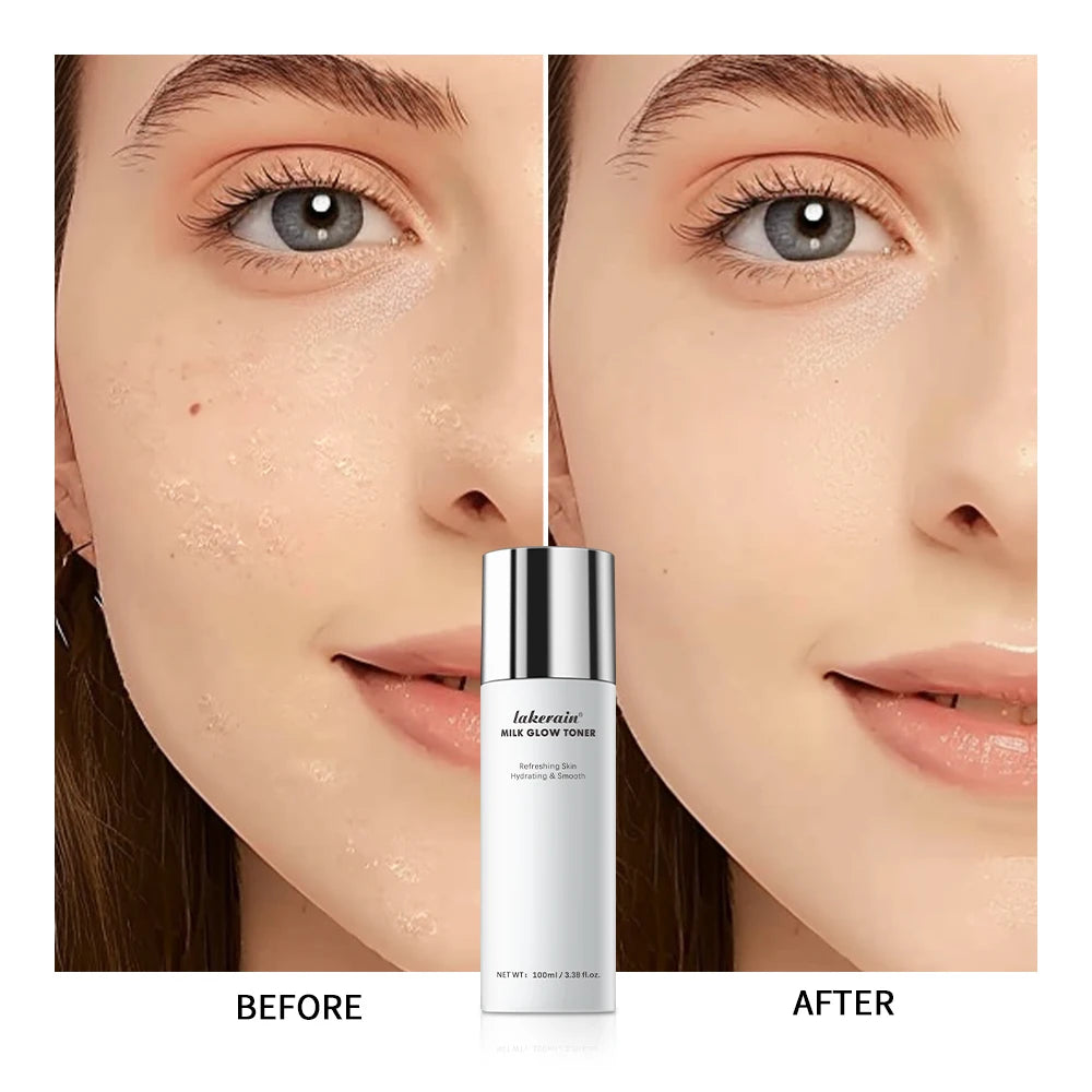 Milk Glow Toner Brightening Skin Care Face Hydration - 6