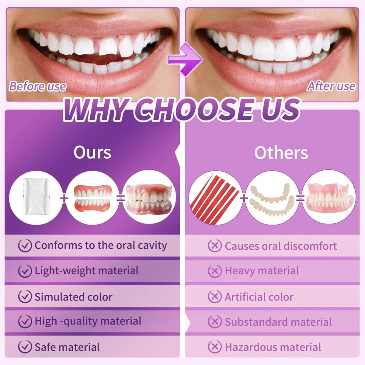 Soft Silicone False Teeth Upper And Lower Cosmetic Dentures