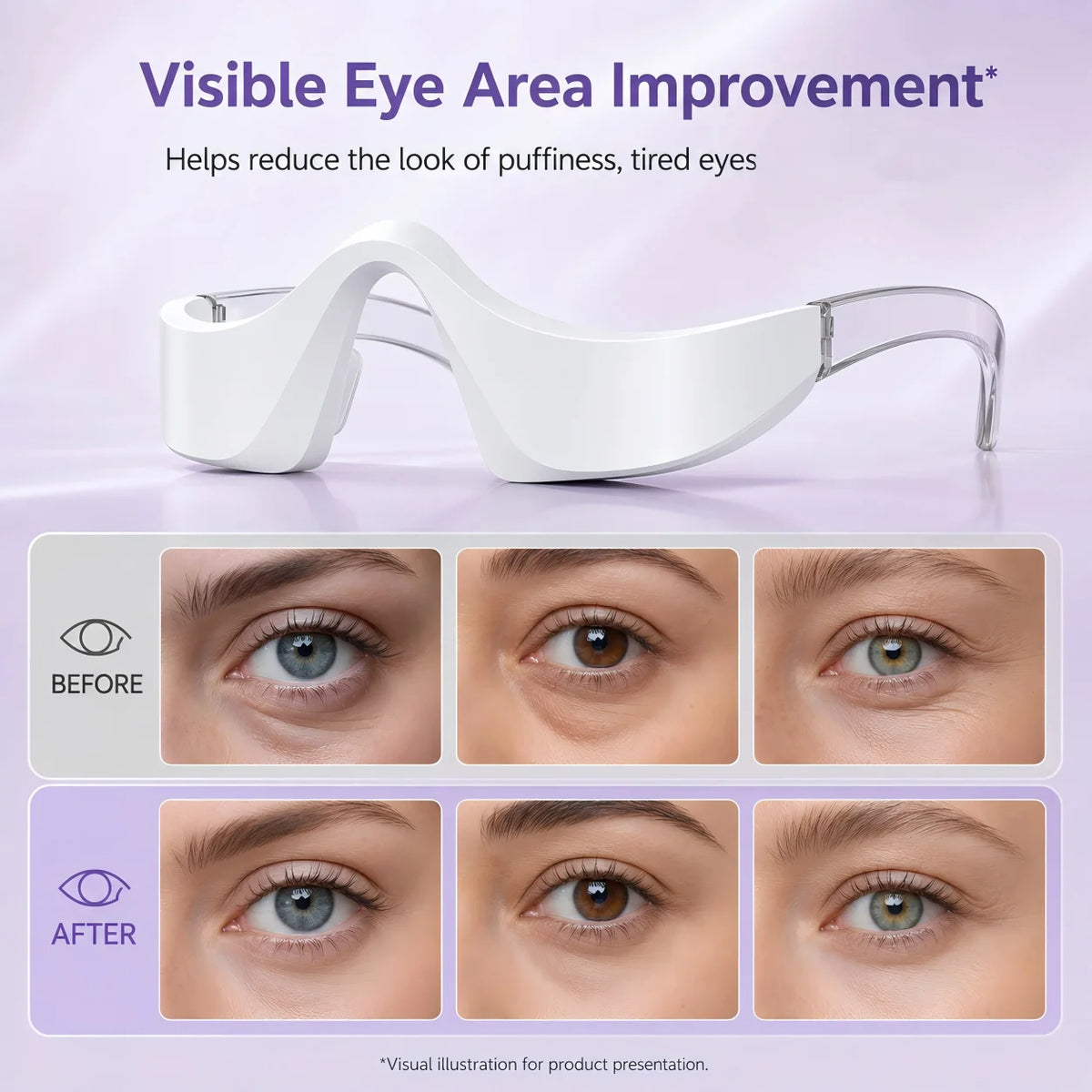 Red Light LED Eye Massager for Puffy Eyes & Dark Circles