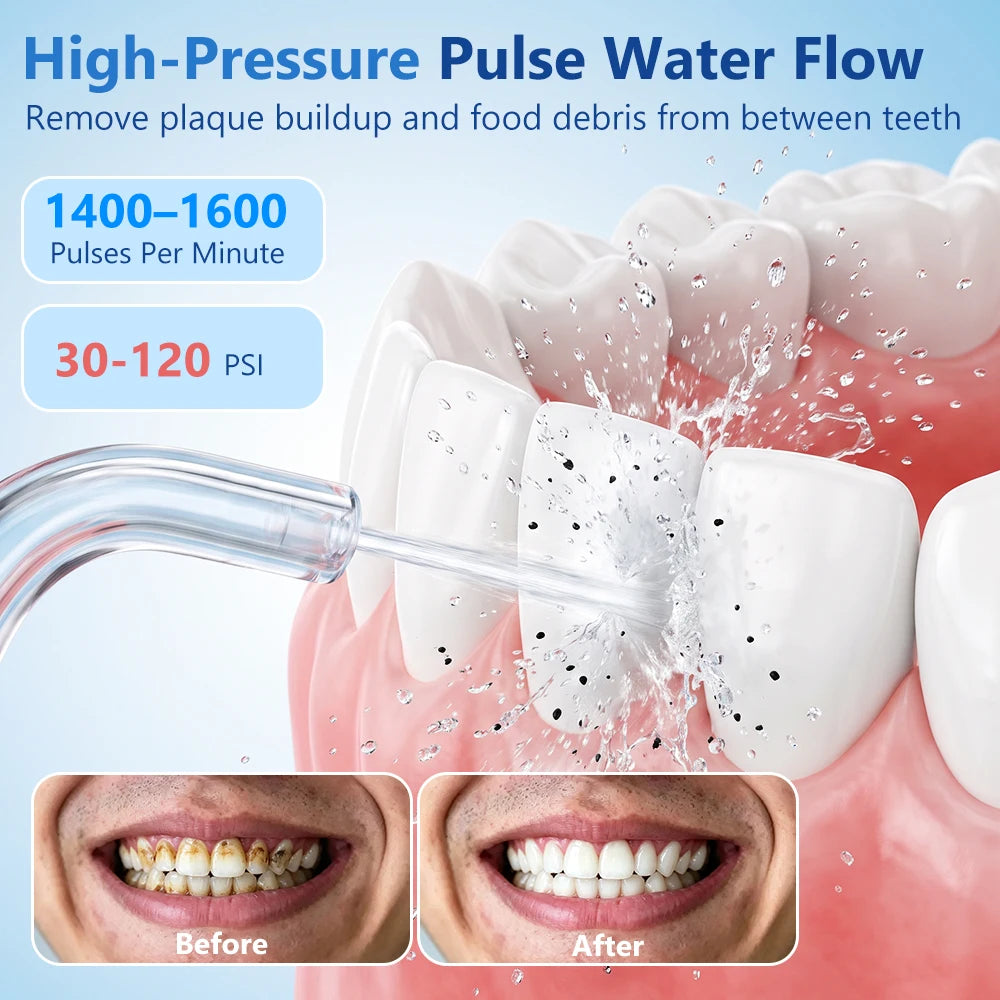 USB Rechargeable Water Flosser Oral Irrigator Dental Cleaner - 9