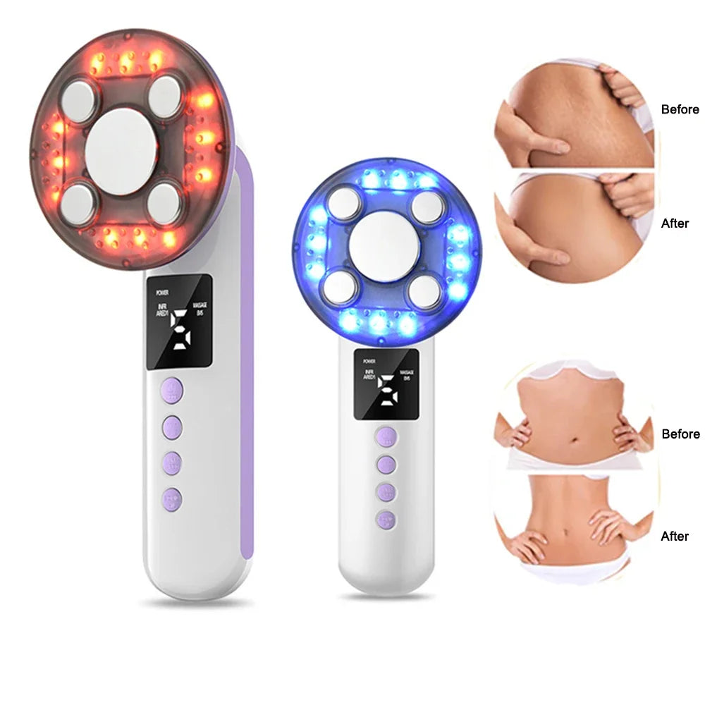 3 in 1 Slimming Body Shaping Massager EMS Cellulite Remover Device - 1