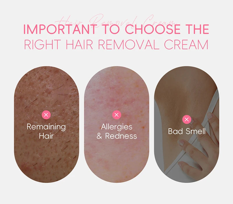 Eelhoe Hair Removal Cream Painless Body Epilator and Growth Inhibitor